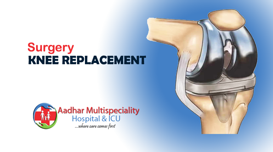 Knee replacement surgery by Dr. Santosh Pandhare aadhar Multispeciality Hospital & ICU Panvel | Best Orthopedic clinic in panvel navi mumbai | Best Joint repalcment Clinic in Panvel Navi Mumbai